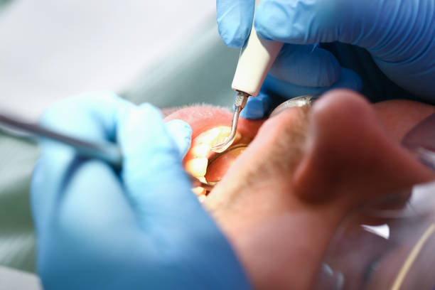 Best Emergency Cosmetic Dentistry (e.g., broken veneers) in Doffing, TX